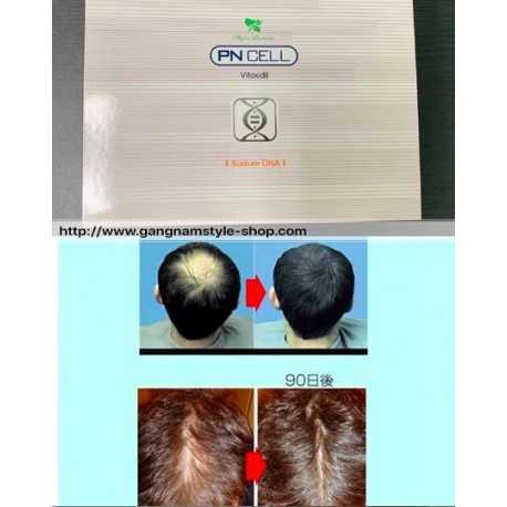 PN CELL Vitoxidil PDRN na vypadávání vlasů